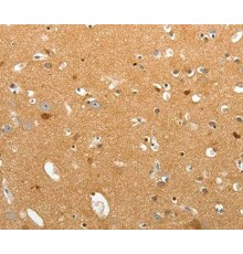 Антитела Tenascin R, кроличьи поликлональные