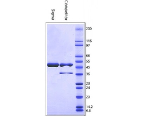 Глюкозо-6-фосфатдегидрогеназа из пекарских дрожжей (S.cerevisiae) Тип XV, лиофилизированный порошок, 200-400 мкг / мг белка (модифицированный Варбург-Кристиан) Sigma G6378